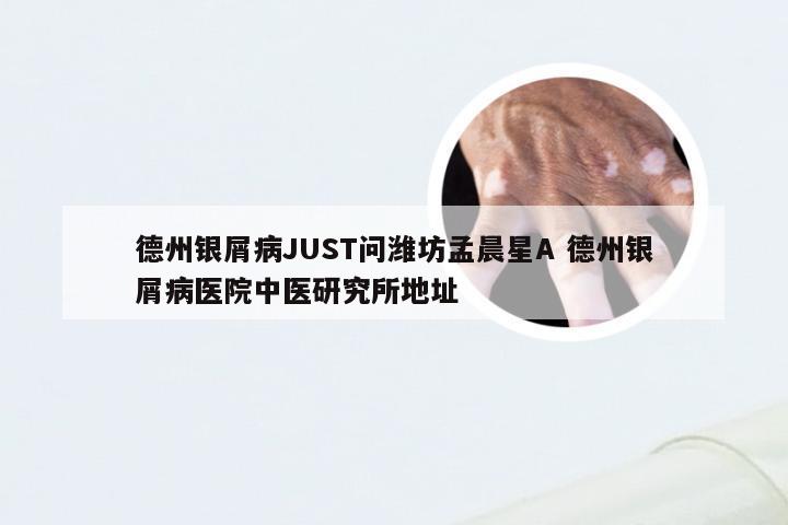 德州银屑病JUST问潍坊孟晨星A 德州银屑病医院中医研究所地址