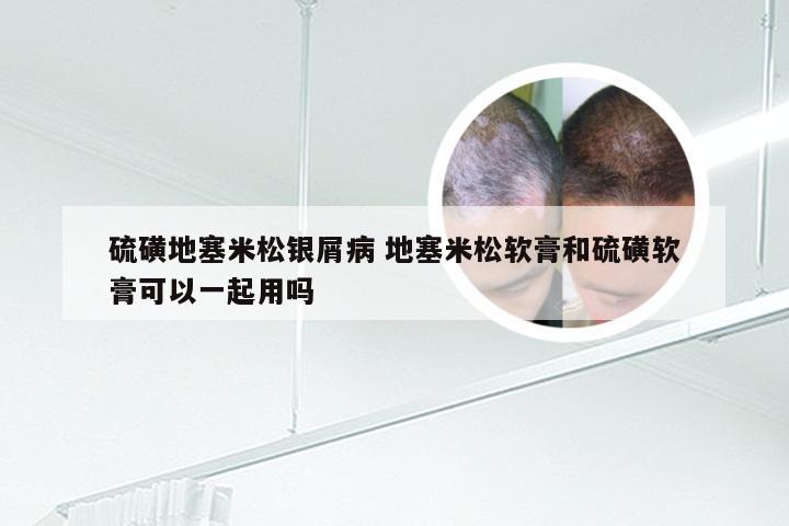 硫磺地塞米松银屑病 地塞米松软膏和硫磺软膏可以一起用吗