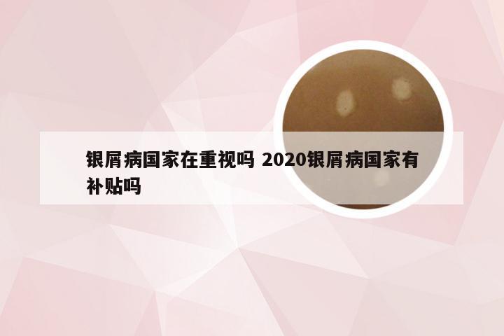 银屑病国家在重视吗 2020银屑病国家有补贴吗