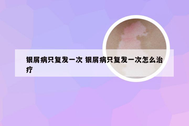 银屑病只复发一次 银屑病只复发一次怎么治疗