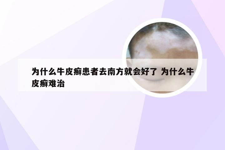 为什么牛皮癣患者去南方就会好了 为什么牛皮癣难治