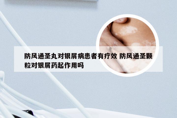 防风通圣丸对银屑病患者有疗效 防风通圣颗粒对银屑药起作用吗