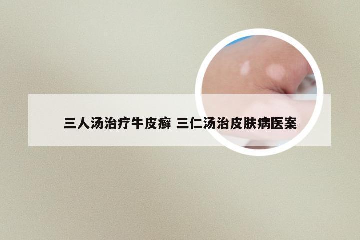 三人汤治疗牛皮癣 三仁汤治皮肤病医案