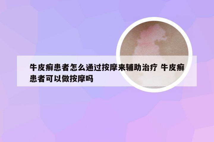 牛皮癣患者怎么通过按摩来辅助治疗 牛皮癣患者可以做按摩吗