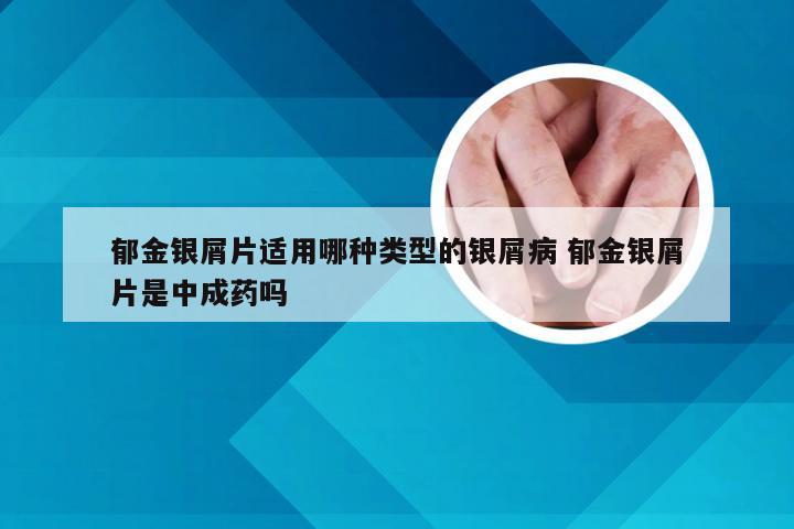 郁金银屑片适用哪种类型的银屑病 郁金银屑片是中成药吗