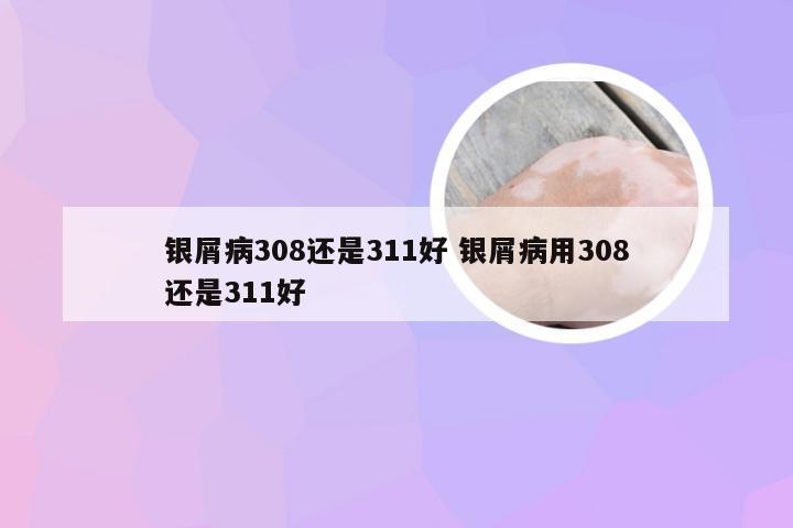 银屑病308还是311好 银屑病用308还是311好