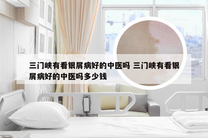 三门峡有看银屑病好的中医吗 三门峡有看银屑病好的中医吗多少钱