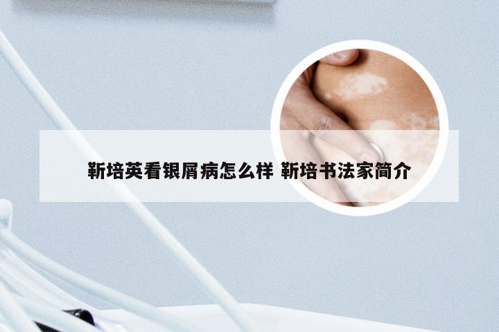 靳培英看银屑病怎么样 靳培书法家简介
