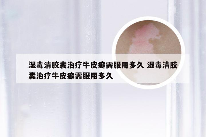 湿毒清胶囊治疗牛皮癣需服用多久 湿毒清胶囊治疗牛皮癣需服用多久