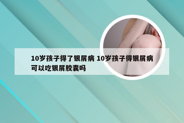 10岁孩子得了银屑病 10岁孩子得银屑病可以吃银屑胶囊吗