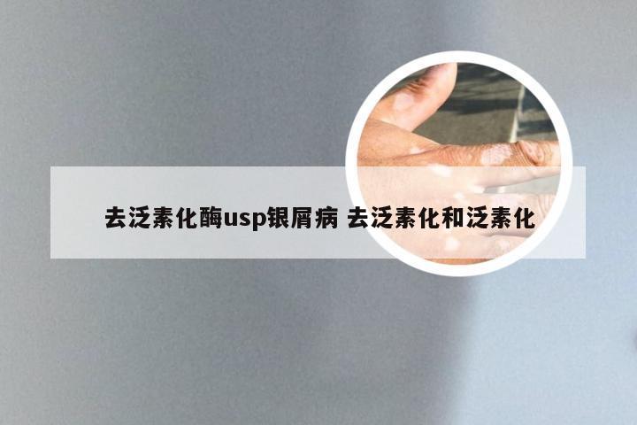去泛素化酶usp银屑病 去泛素化和泛素化