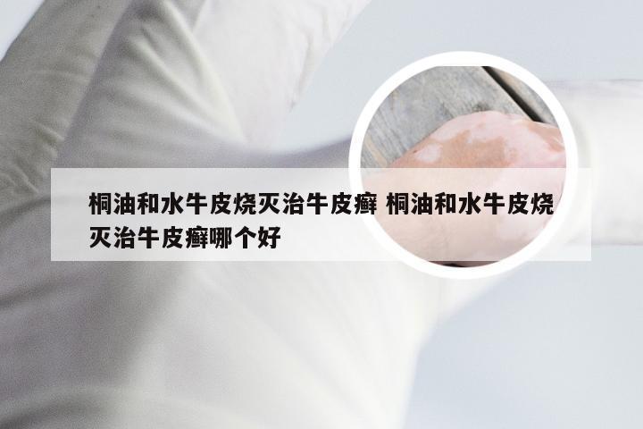 桐油和水牛皮烧灭治牛皮癣 桐油和水牛皮烧灭治牛皮癣哪个好