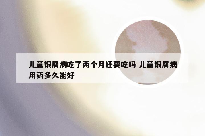 儿童银屑病吃了两个月还要吃吗 儿童银屑病用药多久能好