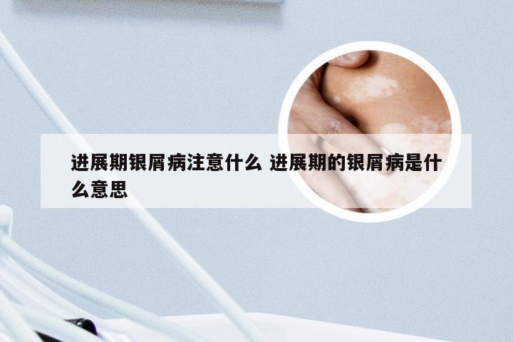 进展期银屑病注意什么 进展期的银屑病是什么意思