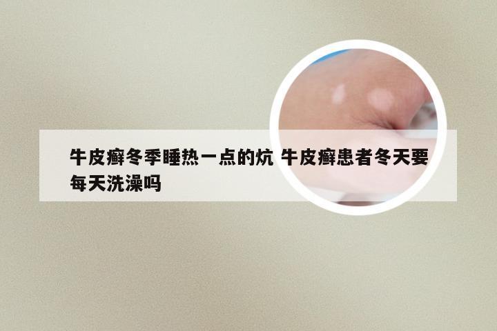 牛皮癣冬季睡热一点的炕 牛皮癣患者冬天要每天洗澡吗