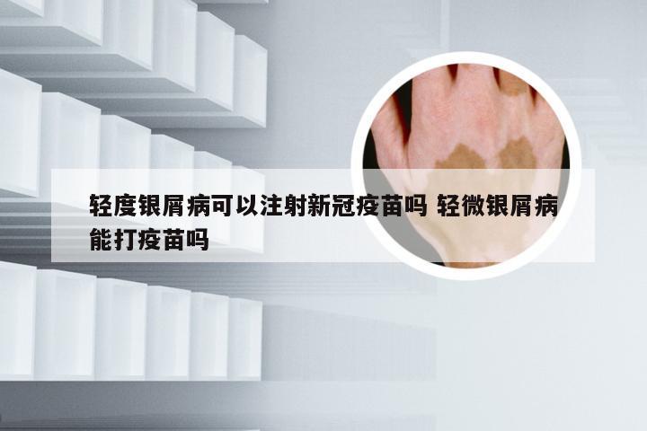 轻度银屑病可以注射新冠疫苗吗 轻微银屑病能打疫苗吗