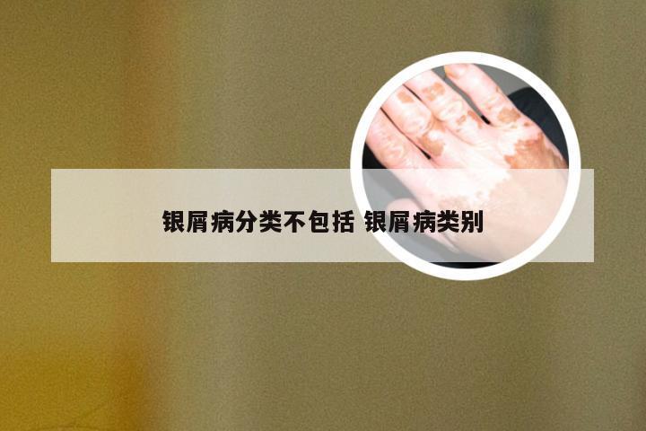 银屑病分类不包括 银屑病类别
