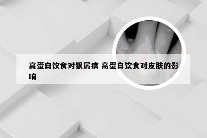 高蛋白饮食对银屑病 高蛋白饮食对皮肤的影响