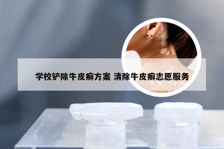 学校铲除牛皮癣方案 清除牛皮癣志愿服务