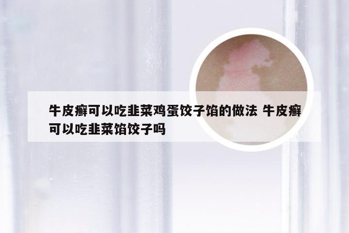 牛皮癣可以吃韭菜鸡蛋饺子馅的做法 牛皮癣可以吃韭菜馅饺子吗