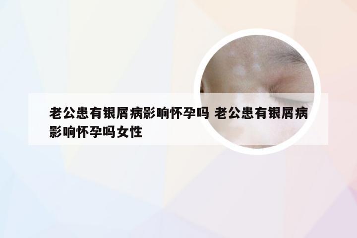 老公患有银屑病影响怀孕吗 老公患有银屑病影响怀孕吗女性