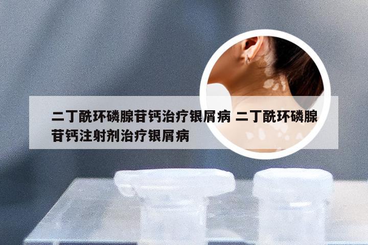 二丁酰环磷腺苷钙治疗银屑病 二丁酰环磷腺苷钙注射剂治疗银屑病