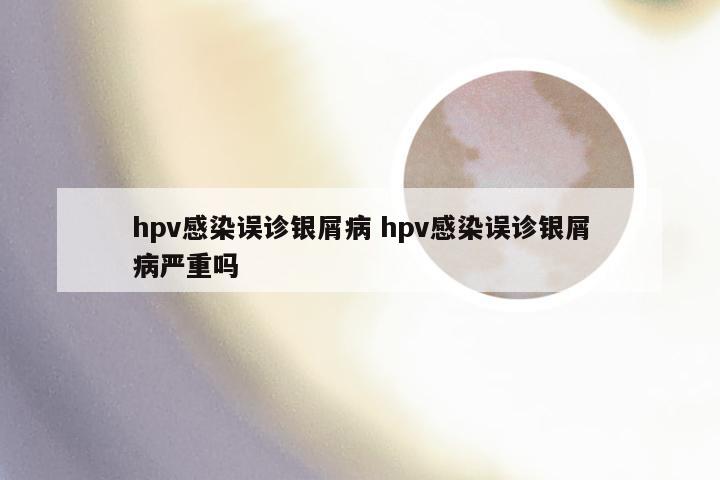 hpv感染误诊银屑病 hpv感染误诊银屑病严重吗