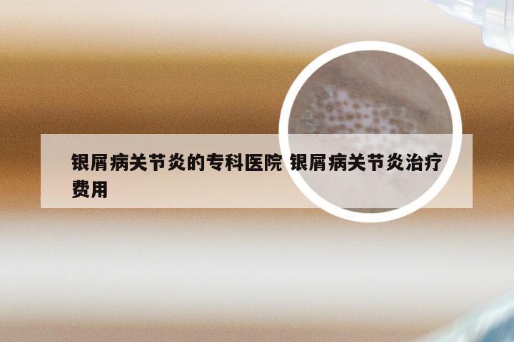 银屑病关节炎的专科医院 银屑病关节炎治疗费用
