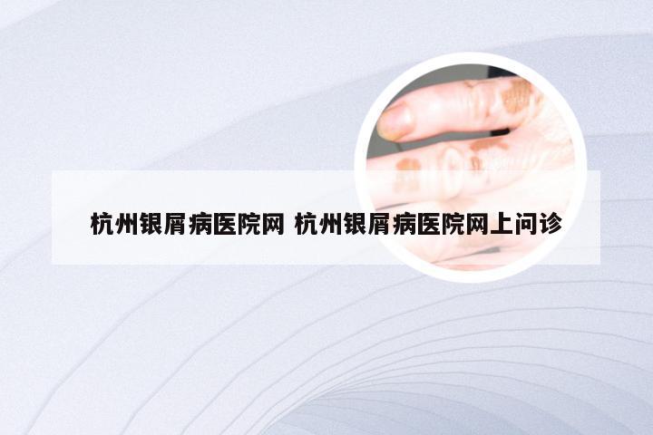 杭州银屑病医院网 杭州银屑病医院网上问诊