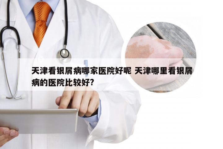 天津看银屑病哪家医院好呢 天津哪里看银屑病的医院比较好?
