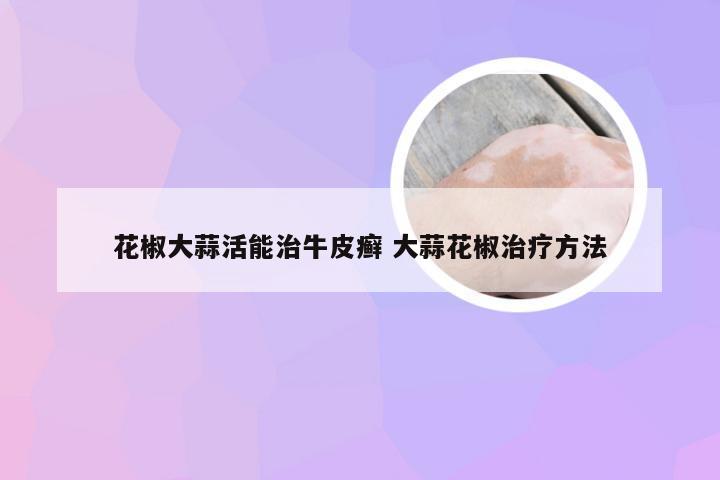 花椒大蒜活能治牛皮癣 大蒜花椒治疗方法
