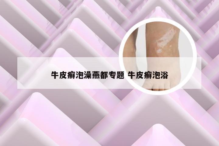 牛皮癣泡澡燕都专题 牛皮癣泡浴