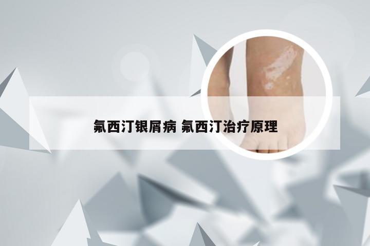 氟西汀银屑病 氟西汀治疗原理