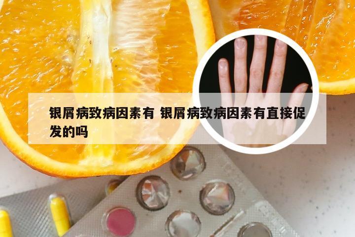 银屑病致病因素有 银屑病致病因素有直接促发的吗