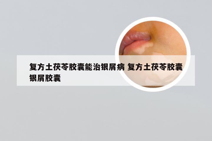 复方土茯苓胶囊能治银屑病 复方土茯苓胶囊银屑胶囊