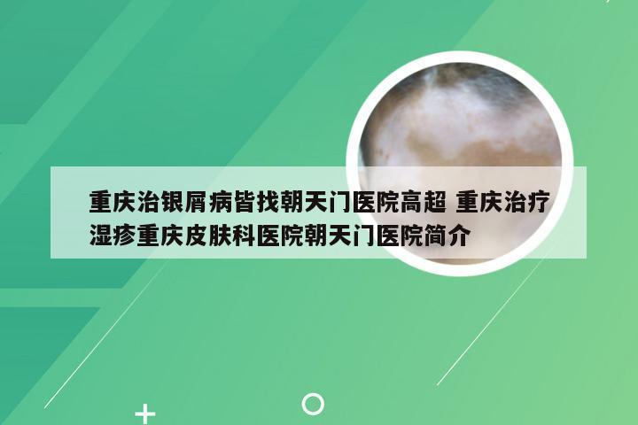 重庆治银屑病皆找朝天门医院高超 重庆治疗湿疹重庆皮肤科医院朝天门医院简介