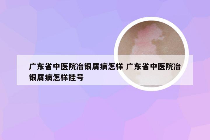 广东省中医院冶银屑病怎样 广东省中医院冶银屑病怎样挂号