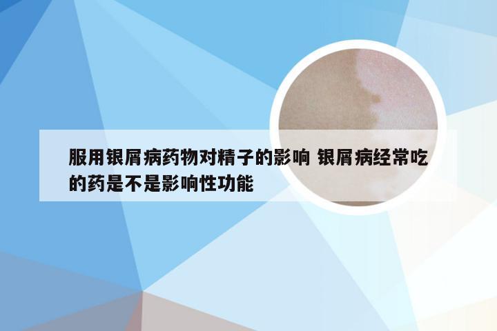 服用银屑病药物对精子的影响 银屑病经常吃的药是不是影响性功能