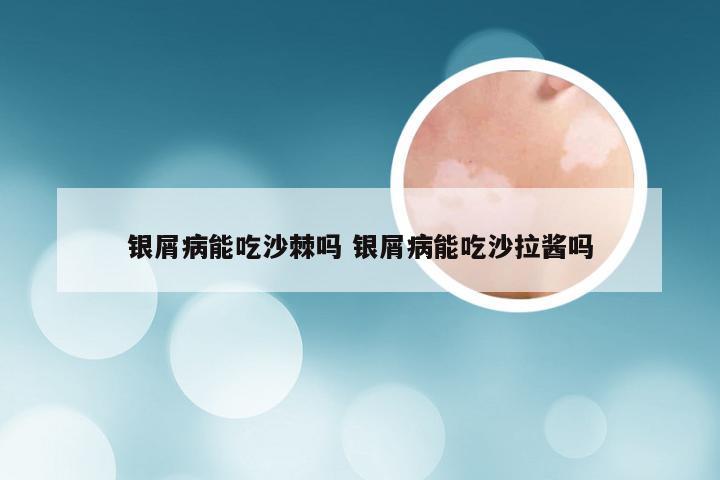 银屑病能吃沙棘吗 银屑病能吃沙拉酱吗