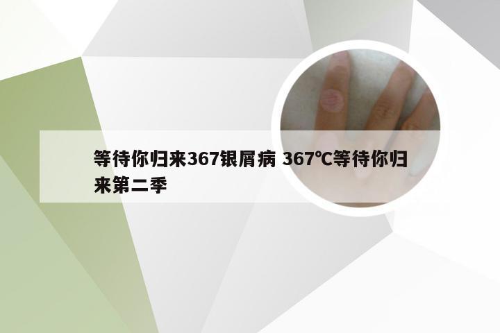 等待你归来367银屑病 367℃等待你归来第二季