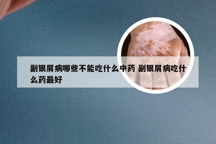 副银屑病哪些不能吃什么中药 副银屑病吃什么药最好