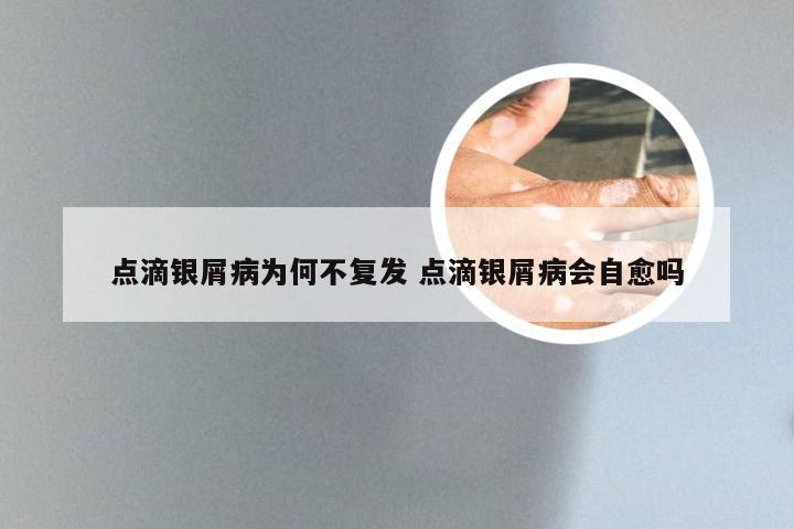 点滴银屑病为何不复发 点滴银屑病会自愈吗