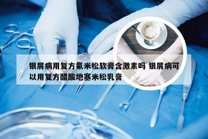 银屑病用复方氟米松软膏含激素吗 银屑病可以用复方醋酸地塞米松乳膏
