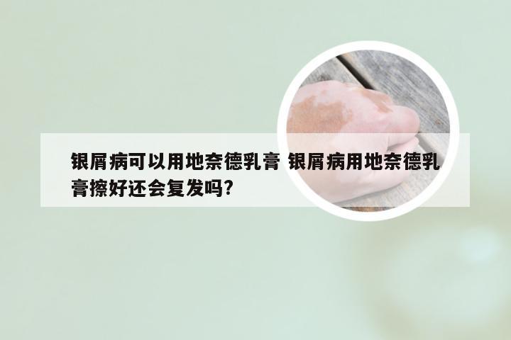 银屑病可以用地奈德乳膏 银屑病用地奈德乳膏擦好还会复发吗?