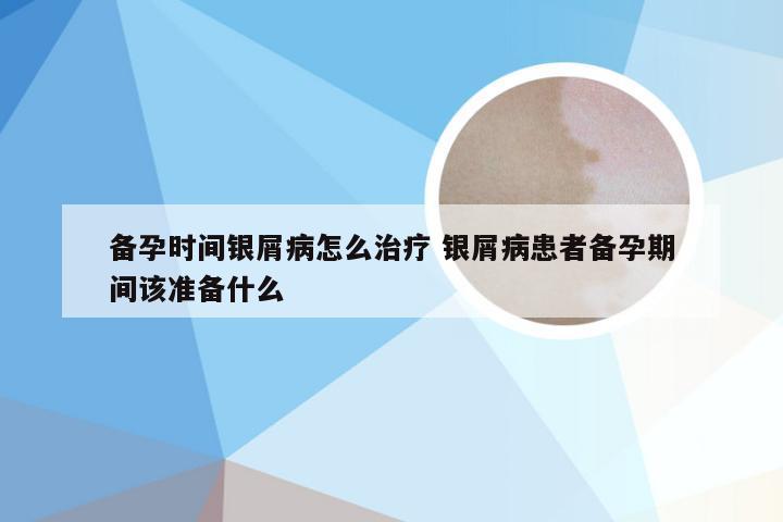 备孕时间银屑病怎么治疗 银屑病患者备孕期间该准备什么