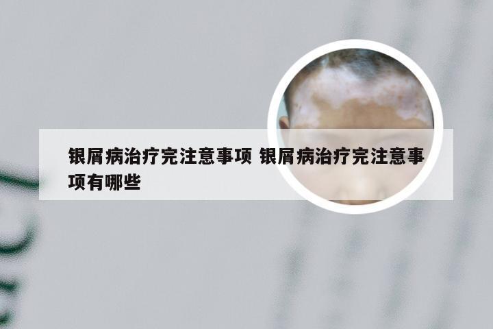 银屑病治疗完注意事项 银屑病治疗完注意事项有哪些