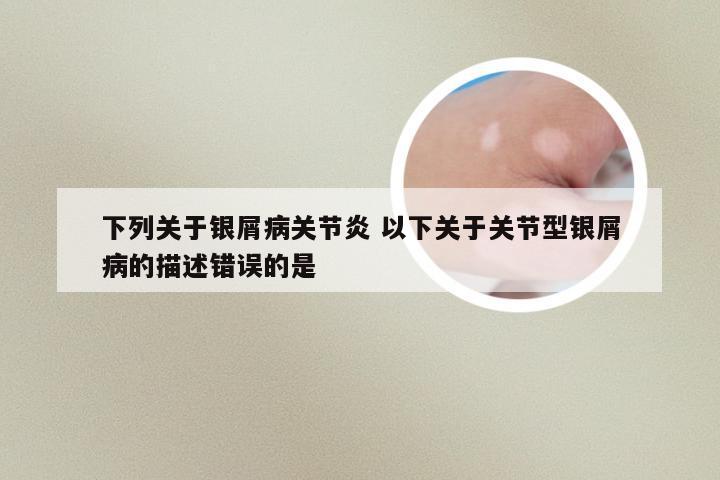 下列关于银屑病关节炎 以下关于关节型银屑病的描述错误的是