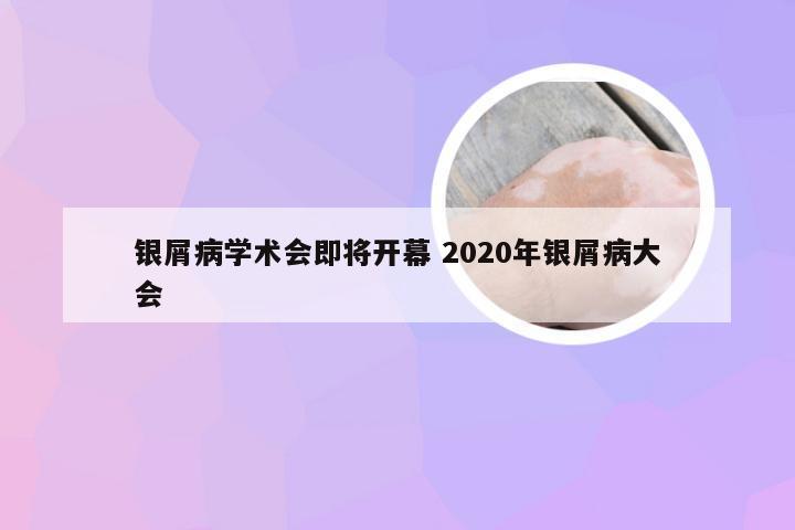 银屑病学术会即将开幕 2020年银屑病大会