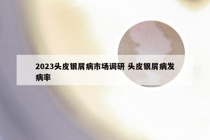 2023头皮银屑病市场调研 头皮银屑病发病率