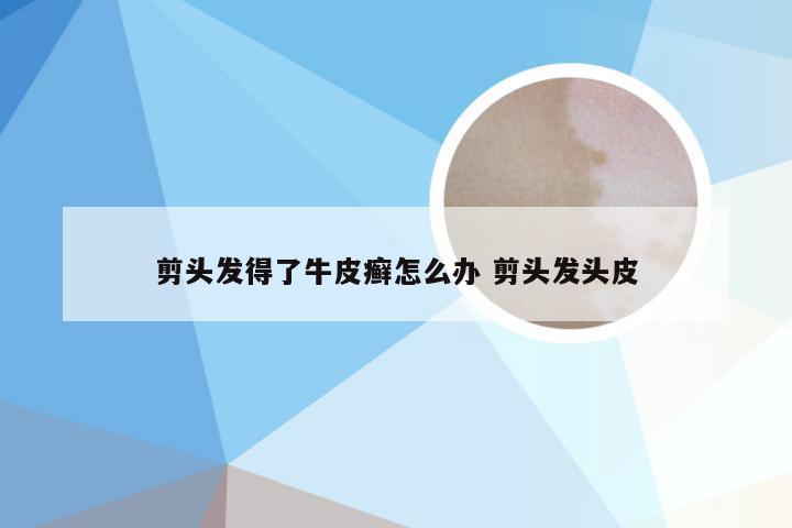 剪头发得了牛皮癣怎么办 剪头发头皮